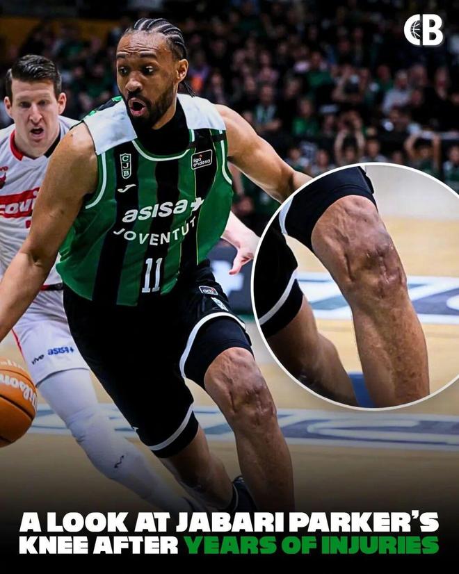 贾巴里帕克伤病毁掉巅峰生涯